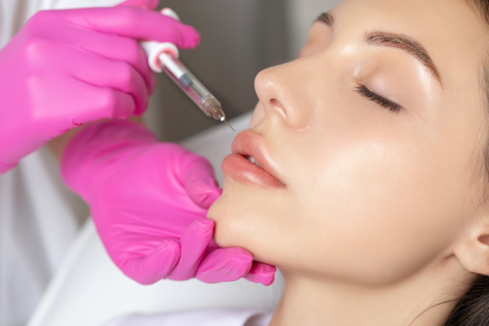 Achieving Natural-Looking Results with Lip Fillers