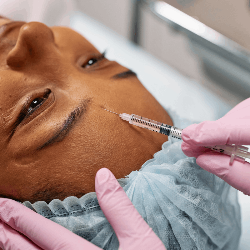 skin tightening treatments for face