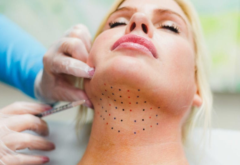 kybella double chin treatment services