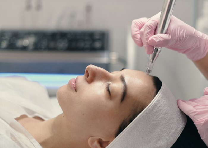 Unlocking the Secrets of RF Microneedling: A Guide to Rejuvenating Your Skin